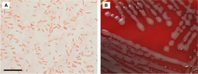 Chimaeribacter arupi a new member of the Yersineacea family has the characteristics of a human pathogen